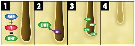 DHT Effects on Your Hair