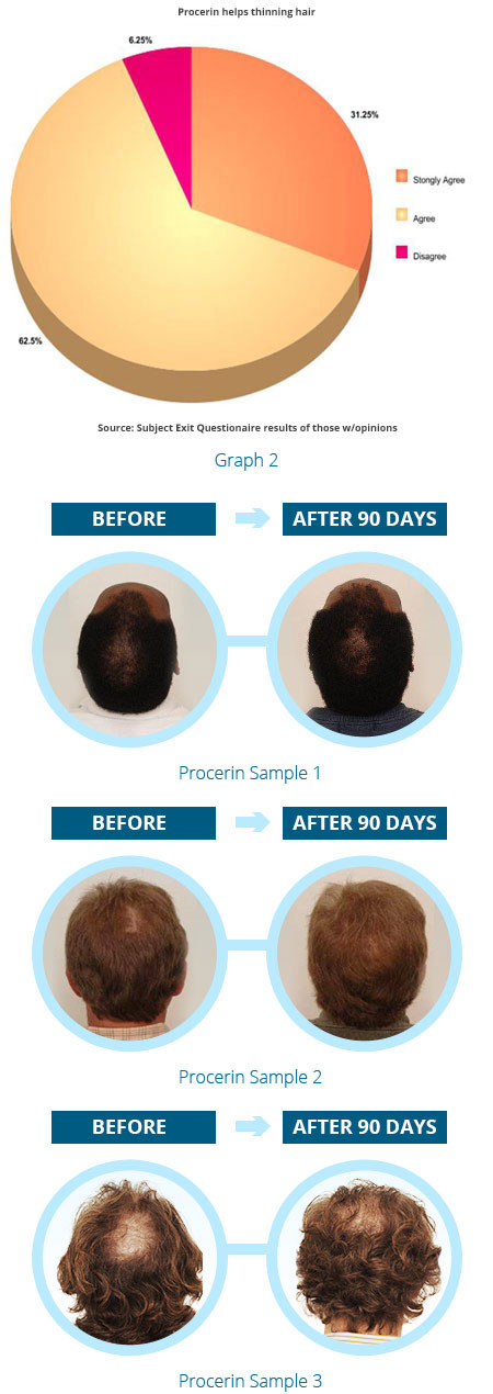 Results from the Procerin Research Study